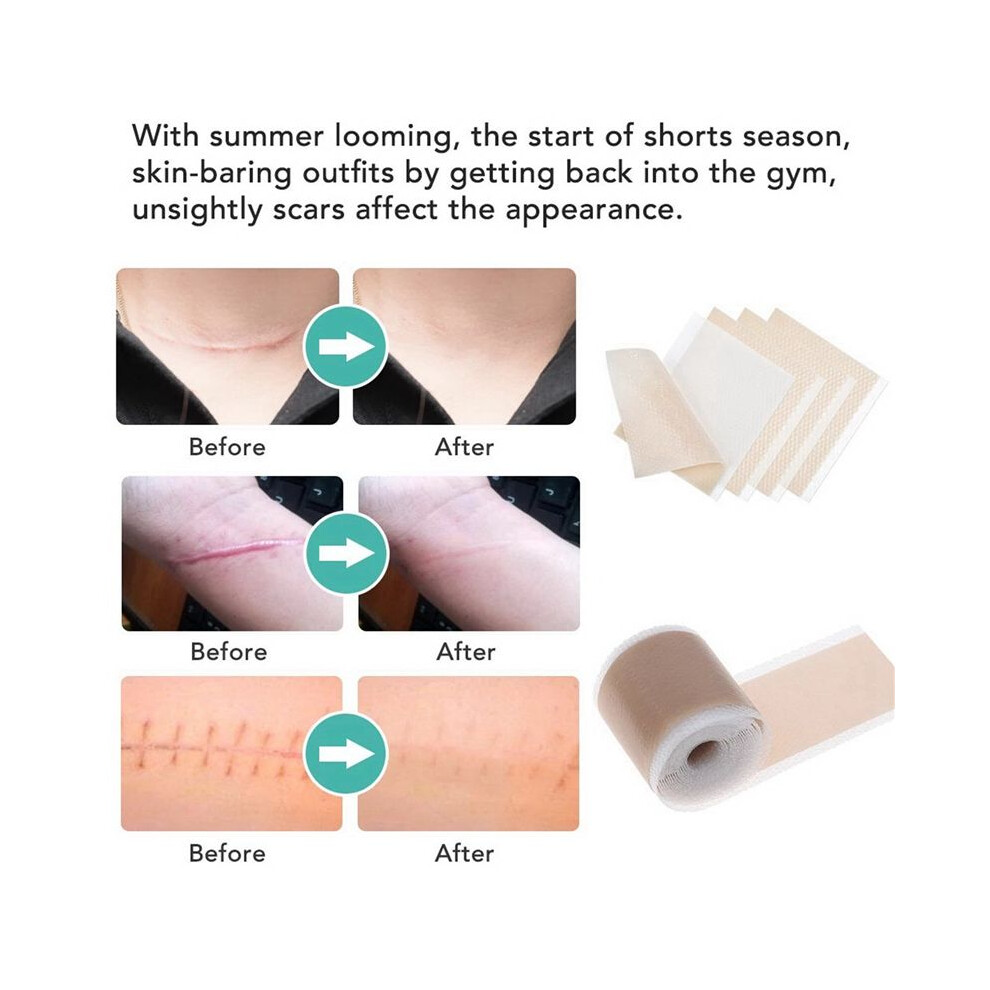 9PC Efficient Surgery Scar Removal Silicone Gel Sheet Therapy Patch for Acne Trauma Burn Scar Skin Repair Scar Treatment