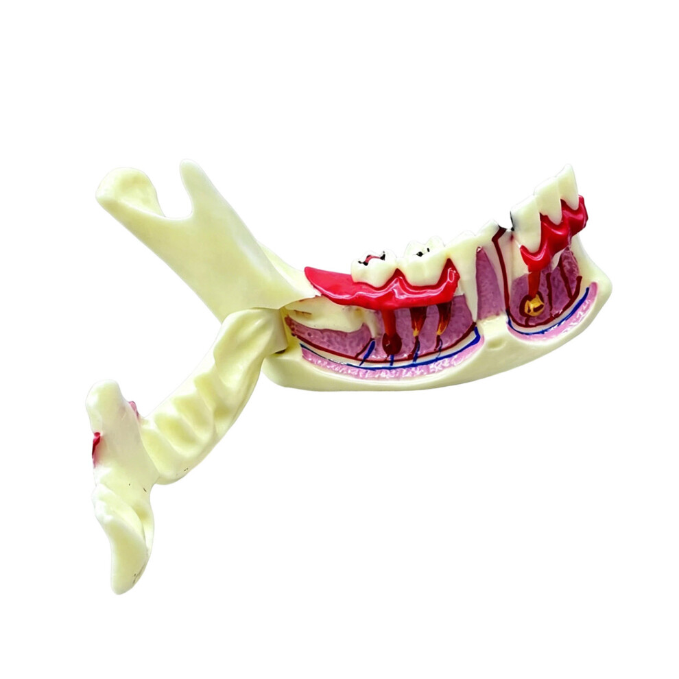 Educational Anatomical Mandible And Gingival Model For Dental