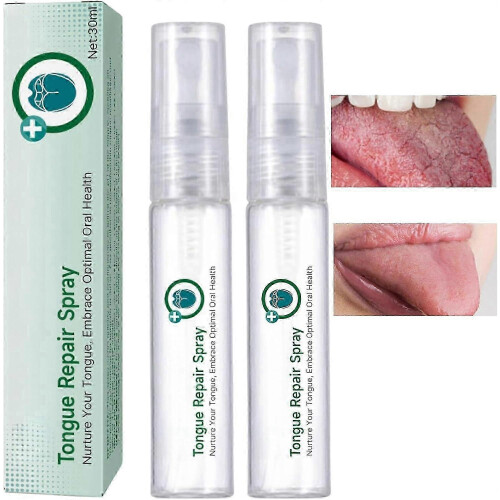 (2pcs) Σπρέι επιδιόρθωσης γλώσσας, εξολοθρευτής οσμής στόματ