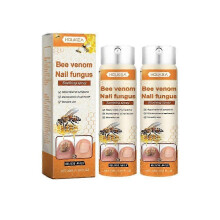 (2pcs) 1–3 x 20 ml Bienengift-Nagelreparaturserum, natürliche Nagelpflege, Spray gegen eingewachsene Zehennägel