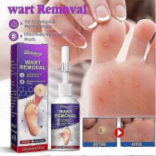 Extra Strength Corn Removal Gel for Hard Skin