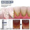 Tartar- Dissolving Tartar Removal Teeth Ful Removal Tootaste 1