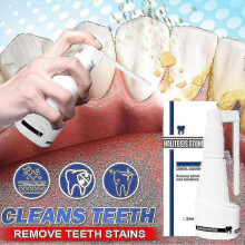 (30ml) 10/30ml Dental Calculus Cleaning Halitosis St Remove Teeth Tw