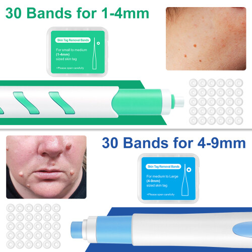 2 Pen Wart Removal Skin Tool Auto Skin Tag Removal Kit 1