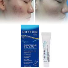 Treatment Gel Acne Facial Skin Care Beauty Reduce Scarring Pores Prevent Clogged