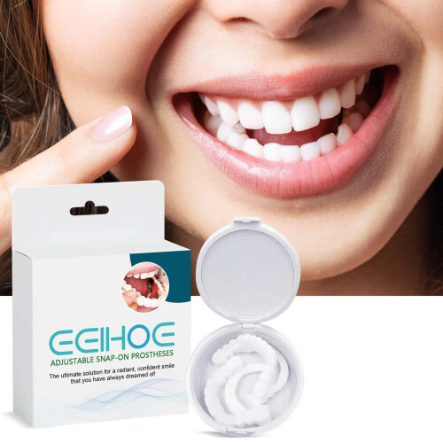 Adjustable snap-on denture for gaps filling & teeth modification, orthodontic aid. 1