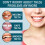 Adjustable snap-on denture for gaps filling & teeth modification, orthodontic aid. 3