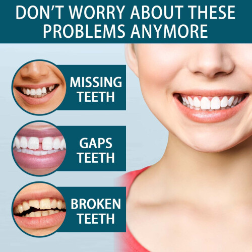 Adjustable snap-on denture for gaps filling & teeth modification, orthodontic aid. 2