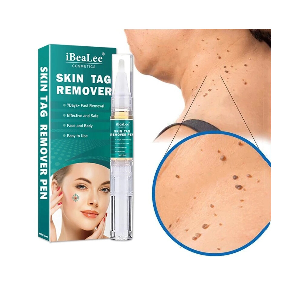 Stoyotu Dark Skin Tag Remover Pen Tagwort Removal 7 Days 5Ml Painless Warts Removal Mole Remedy Liquid Pen Fast Spot