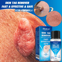 Skin Tag Remover Fast Effective Safe 20ml