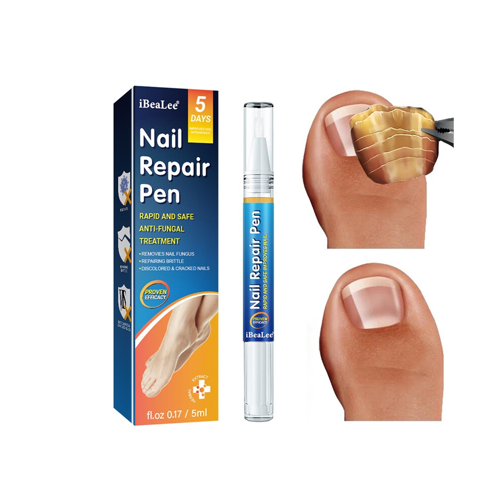 Stoyotu Nail Fungal Treatment Effective Restoring Solution Nail Soothing Nail Repair Pen Hand Foot Nail Care 5Ml
