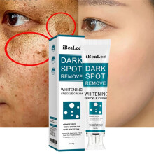 Whitening Freckle Cream Remove Melasma Dark Spots Cream Anti-Aging 20ml