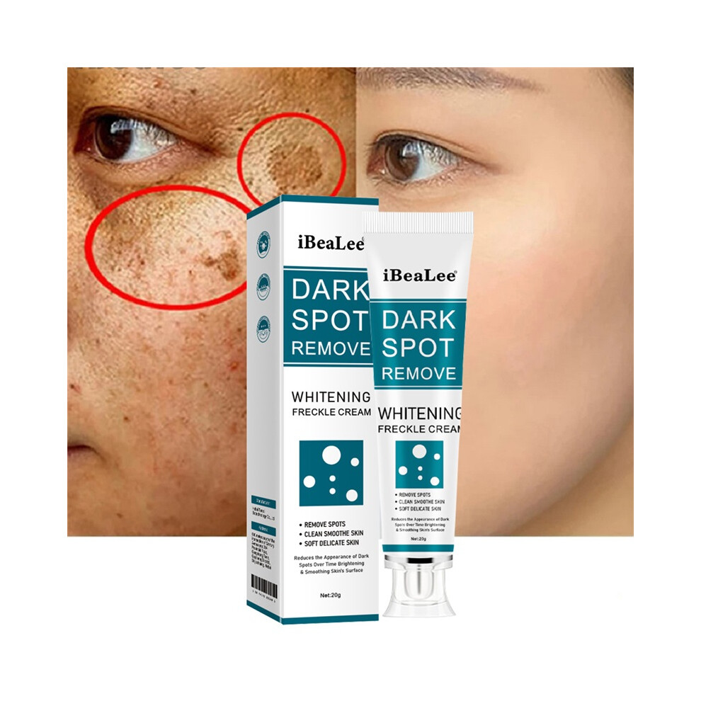 Stoyotu Cream/Dark Whitening Freckle Remove Melasma Spots Anti-Aging 20Ml