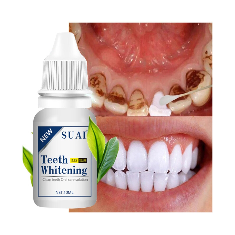 Stoyotu Teeth Whitening Essence Remove Plaque Stains Serum Fresh Breath Oral Hygiene Against Dental Caries Dental Teeth Bleaching Tools 10Ml