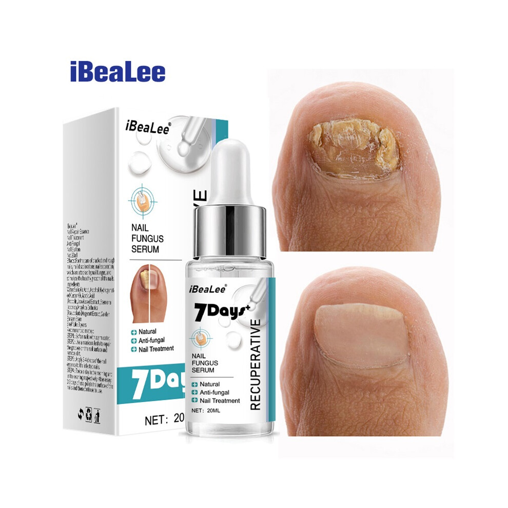 Stoyotu Nail Fungus Serum Nail Repair Liquid 7 Days To Cleaner Nourished Nails 20Ml