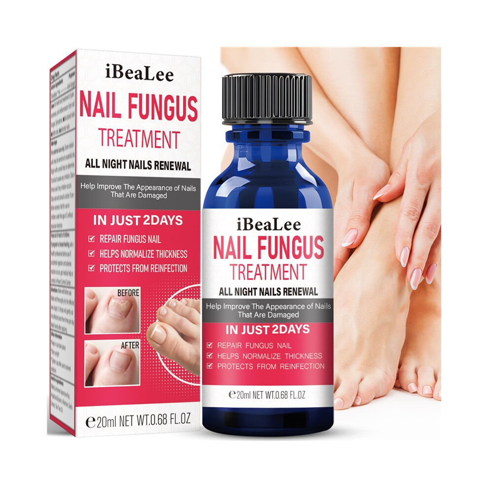 Stoyotu Nail Fungus Treatment Essence Thickens Nails Disinfects Serum Inhibits Prevents Infections Safe Nail Repair Antibacterial Solution Liquid 20Ml