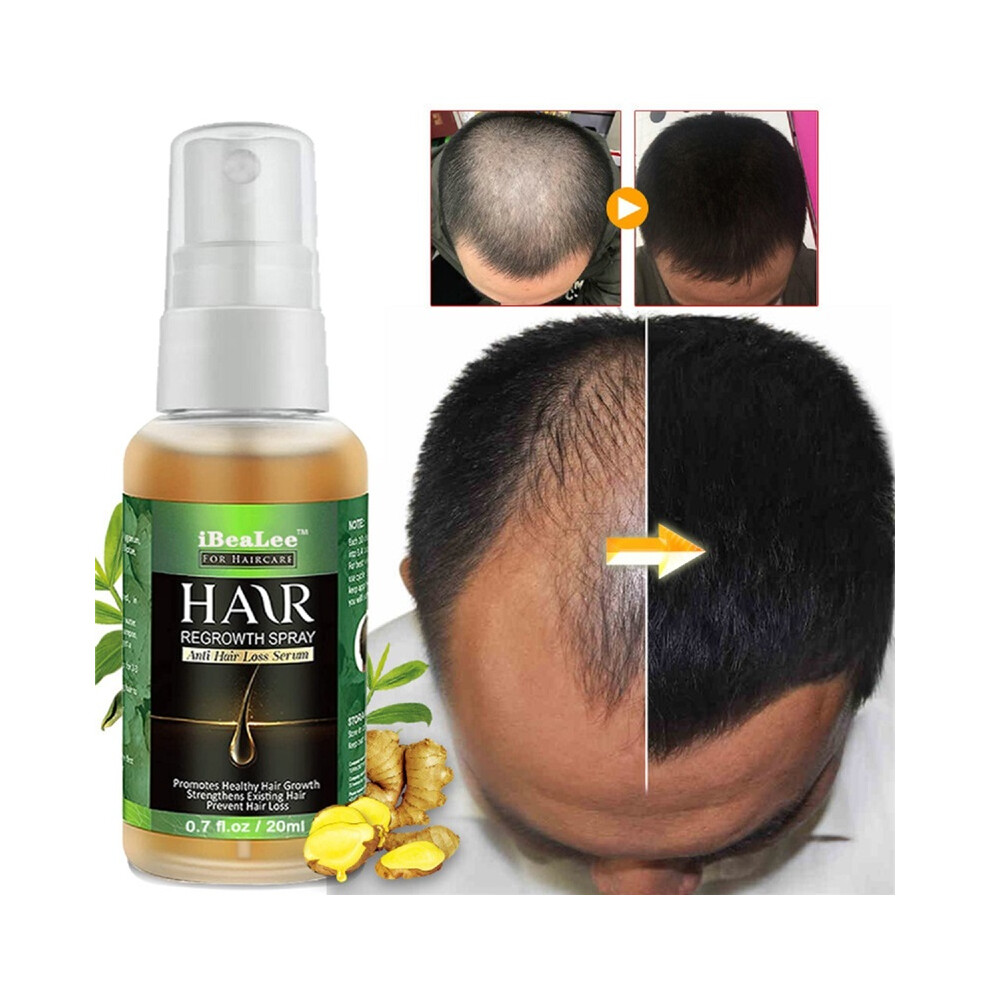 Stoyotu Hair Growth Booster Serum, Ginger Hair Growth Serum, Hair Regrowth Spray, Hair Growth Essential Oils, Hair Regrowth Serum Spray 20Ml