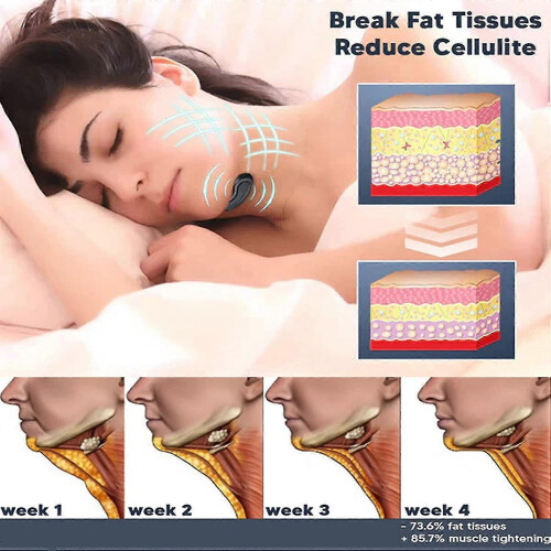 Ρυθμιζόμενη λαβή 5-60kg 2