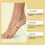(2 Boxes) 30pcs Extra Strength Corn Removal Pads for Feet & Toes, Corn Removers 4