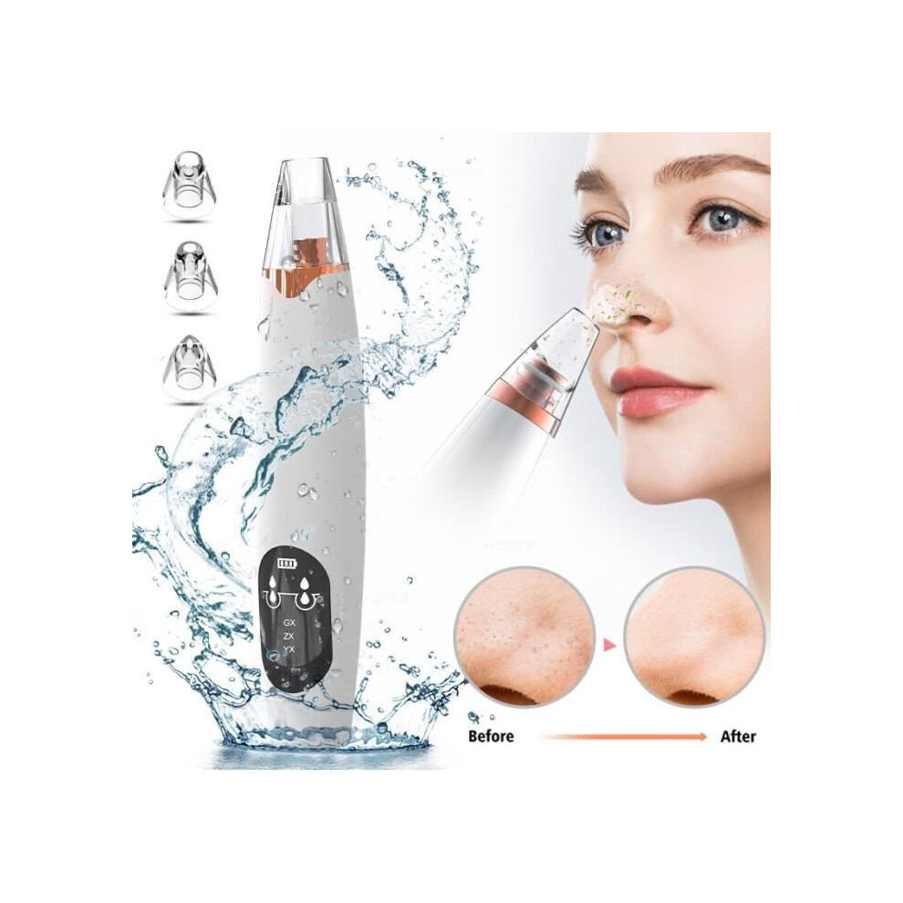 White Rechargeable Blackhead Remover Vacuum, Facial Pore Cleaner For Deep Skin Cleansing, Compact And Portable
