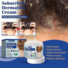 Seborrheic Dermatitis Cream, Psoriasis Cream, Scalp Treatment for Psoriasis, Anti-Itch Cream, Provides Soothing Relief