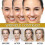 3x Advanced Bee-venom Serum Anti-aging Moisturizer for Face And Neck-- 3