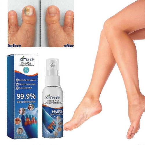(1pcs) 1-3x Ιατρικό σπρέι ποδιών για μύκητες νυχιών, Φυτική φροντ
