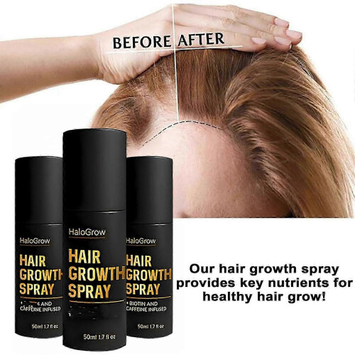 (2pcs) Σπρέι ανάπτυξης μαλλιών HaloGrow, προάγει την πυκνότητα και 2