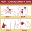 Tiger Skin Joint Care Patch 10 Patches/box 4