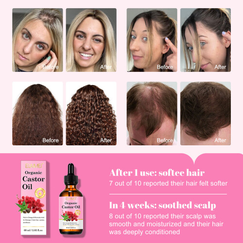 Castor Oil 60ml 2