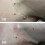 Skin Tag Remover Fast Effective Safe 20ml 2
