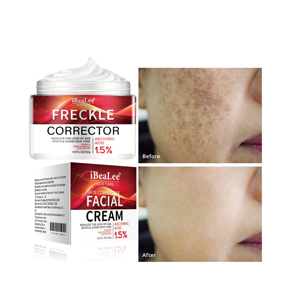 Stoyotu Cream Whitening Freckle Hydrating Moisturizing Reduce Wrinkle Repairing Firming Intensive Spot Removal Anti-Wrinkle Face 30G