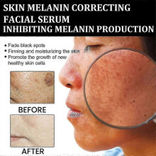 Eelhoe Melanin Correcting Facial Serum, Dark Spot Corrector Daily Face Serum New New Arrival S03