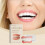 Oralhoe Silicone Denture Set: Beautiful Teeth, Enhanced Smile, Comfortable Material Denture Care Set 2