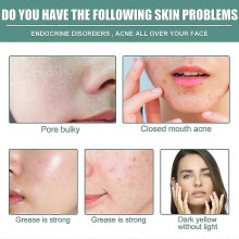 Retinol Serum, Facial Elasticity Anti-aging Shrink Pores Brightening And Firming Serum