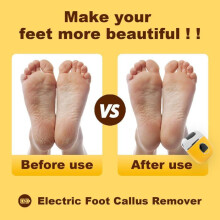 Electric Foot File Callus Remover for Dead Skin Exfoliation, Rechargeable, Compact and Easy to Use