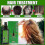 (360ml) Νέα λοσιόν μαλλιών Thailand Neo 120ml Essence κατά της τριχόπτωσης, θ 2