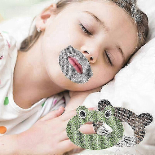 (30Pcs Frog) Παιδικά αυτοκόλλητα στεγανοποίησης με κινούμενα σχέδια, ο 1