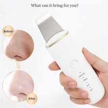 Ultrasonic Skin Scrubber Vibration Face Spatula Blackhead Remover Shovel Clean Cavitation Peeling Facial Lifting Skin Care Tools