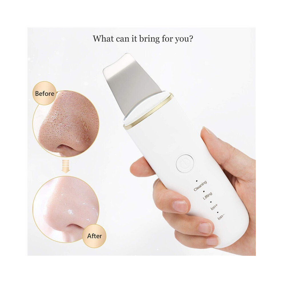 Stoyotu Ultrasonic Skin Scrubber Vibration Face Spatula Blackhead Remover Shovel Clean Cavitation Peeling Facial Lifting Skin Care Tools