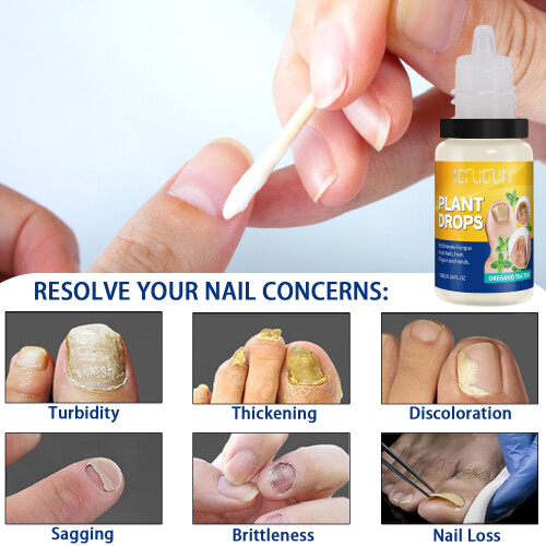 Nagelvloeistof 10ml 2