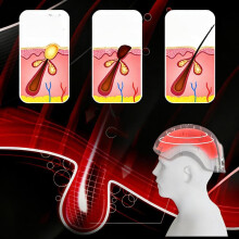 700nm LED Photon Scalp Care Growth Hair Regrowth Device for Anti Hair Loss,Thinning Scalp Relief, Stress Reduction