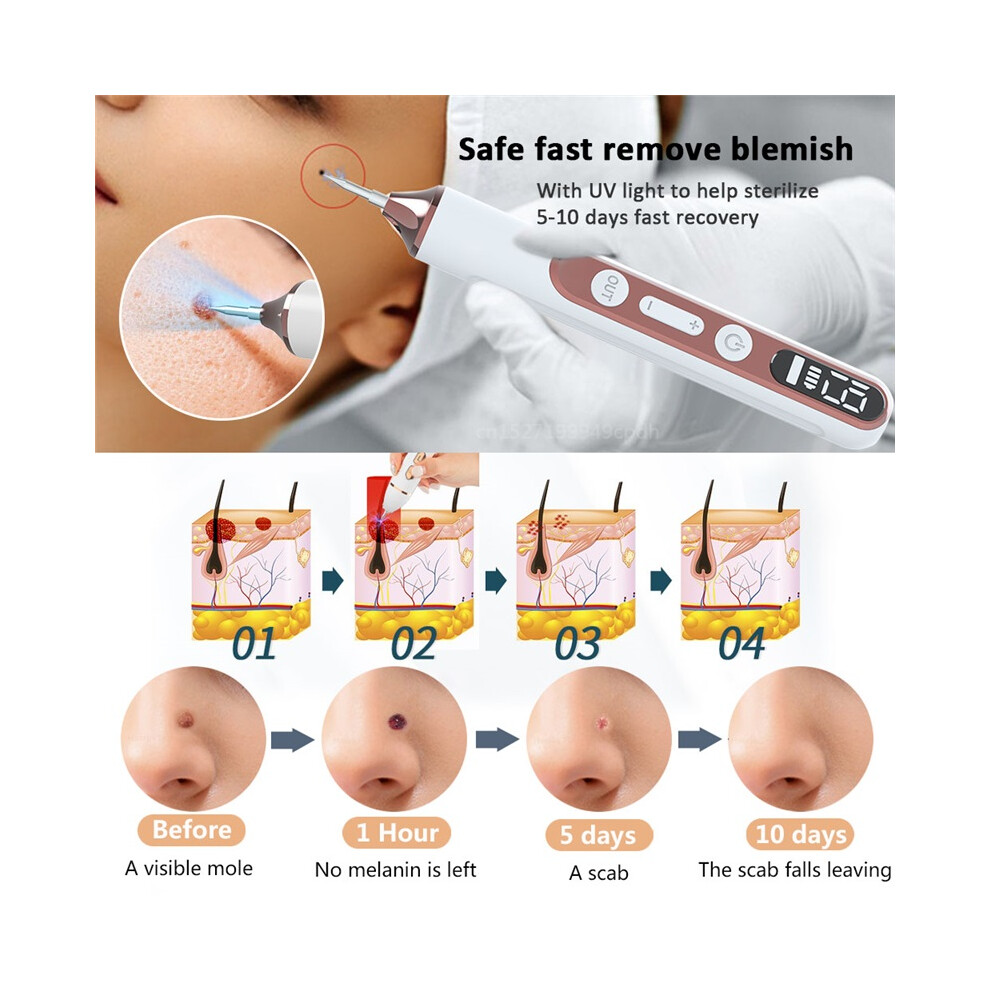 Stoyotu Black/Dark Laser Plasma Pen Warts Dots Remover Mole Wart Eliminator Papilloma Mole Nevus Freckles Spots Remover Skin Tag Remover
