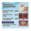 2025 Glidewellpd Silicone Denture Smileasego Mouth 4