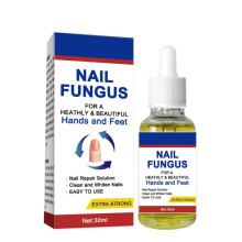 Nail Fungus Care Solution Antifungal Liquid 30ml Fast Penetration Nail Repair Protective Layer for Adults