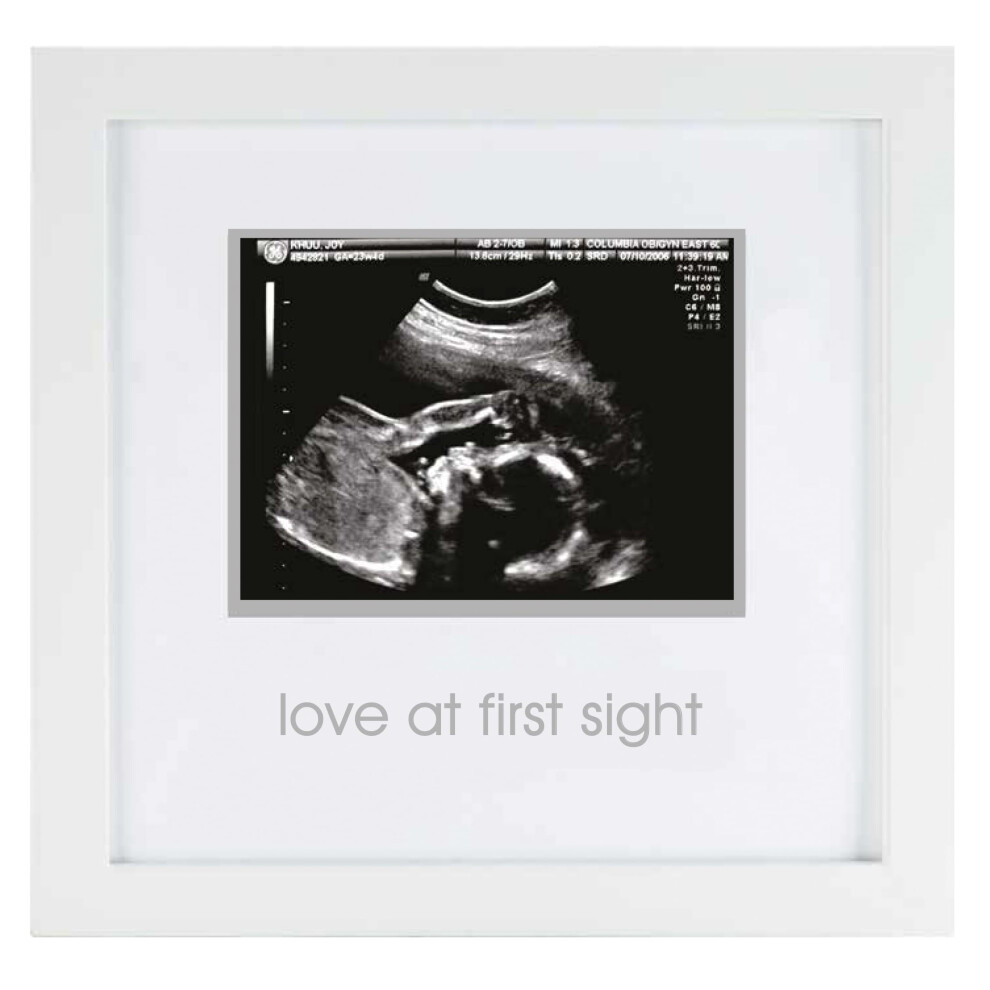 Love At First Sight Sonogram Picture Frame, Gender Neutral Ultrasound Keepsake, Ideal Pregnancy Gift, Baby Shower And Nursery Decor, White Pearhead
