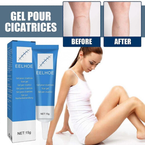 Scar Repair Gel 1