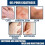 Scar Repair Gel 3