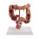 Teaching Model,Human Large Intestine Anatomy Model Visceral Lesion Model Human Digestive System Learning Model 1