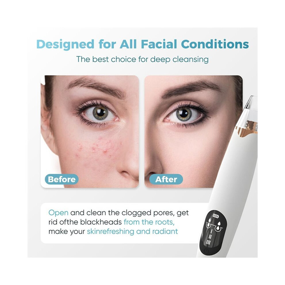Blackhead Remover Pore Vacuum with  LED Display, 65Kpa Suction Facial Cleaner